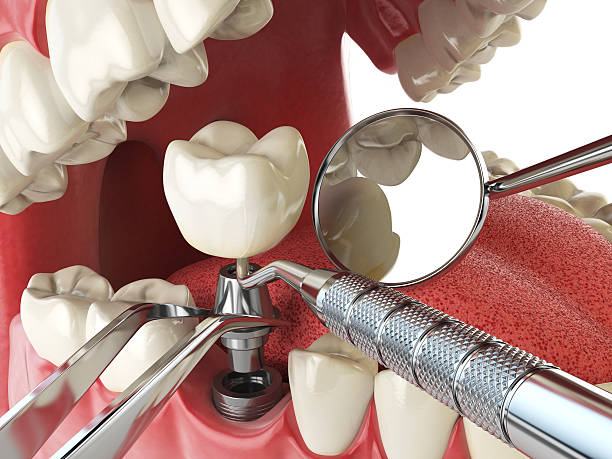 Best Dentist for Tooth Abscess  in Prospect, PA