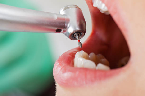 Best Cracked Tooth Emergency Dentist  in Prospect, PA